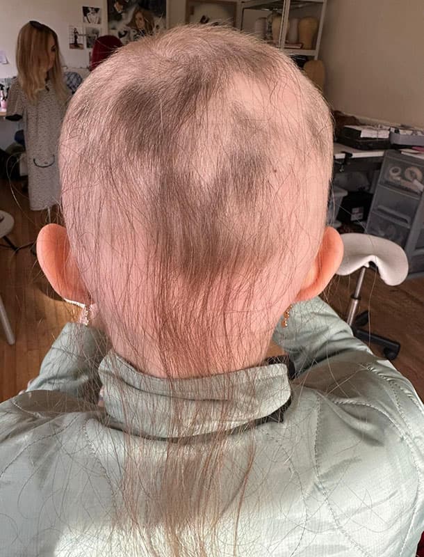 Lyra before receiving her wig